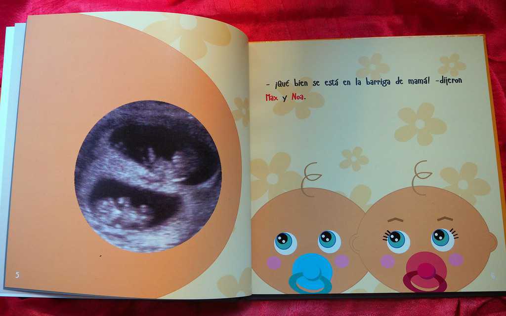 Libro personalizado con ecografía real del bebé